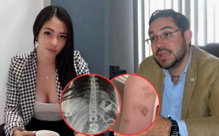 Pareja de Diputado, Jorge Cálix, denuncia a este ante el MP por violencia familiar