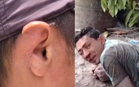 Hombre "canibal" causa terror en Cucuyagua, Copán